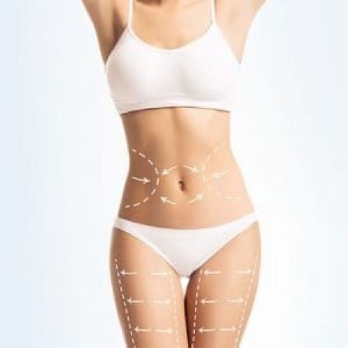 fat-dissolving-injection-2-ootexyidrhxl9186qel879pj5v37lqtlvyhuoqrut4.jpg